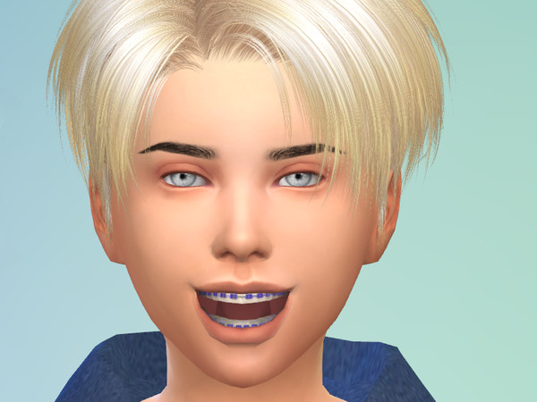 Sims 4 — Brackets kids V1 by Kastha_Bomb — Forgive my english... I speak Spanish Brackets for children and teens of