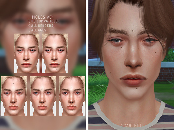 Sims 4 — Moles #01 by Scarlett-content — - HQ compatible; - all genders; - all ages.