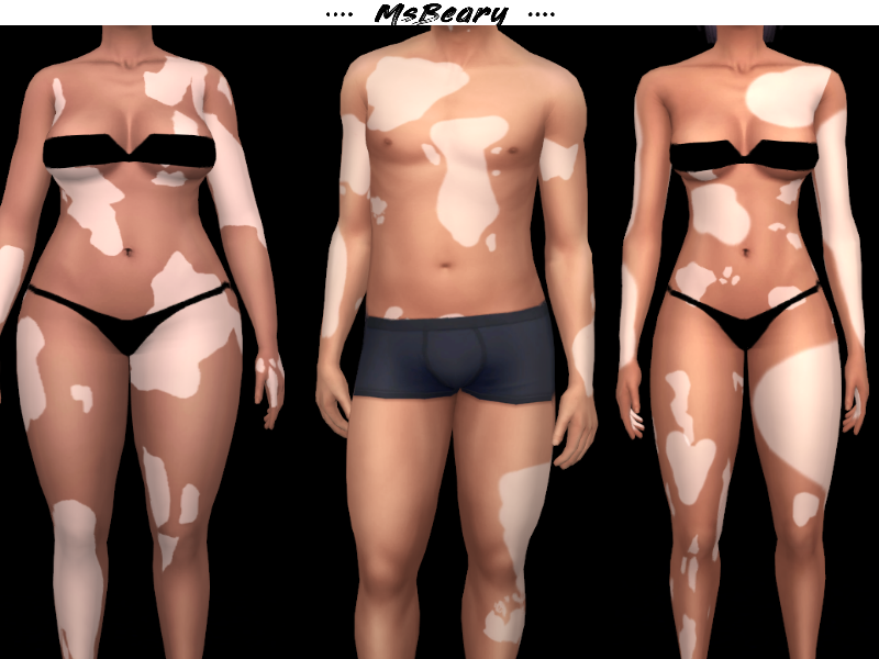 21 unique vitiligo options sims 4 