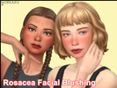 Sims 4 — Rosacea Facial Blushing by MsBeary — A common skin condition that causes a range of blushing to the body (mostly