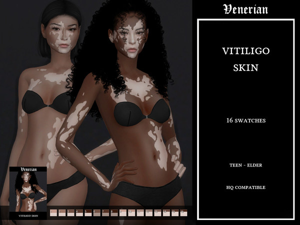 Sims 4 — Vitiligo Skin - Female - by Venerian by Venerian — 16 swatches Found in the skin detail category Teen to elder